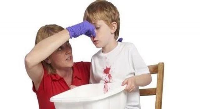 Burun kanamasında doğru ilk yardım nasıl yapılır? 3 burun kanamasinda dogru ilk yardim nasil yapilir 1789851340 FDY6DL